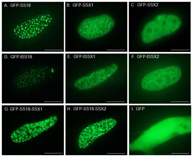 GFP-fused-proteins-were-observed-using-a-fluorescence-microscope-A-GFP-SS18-B.jpg